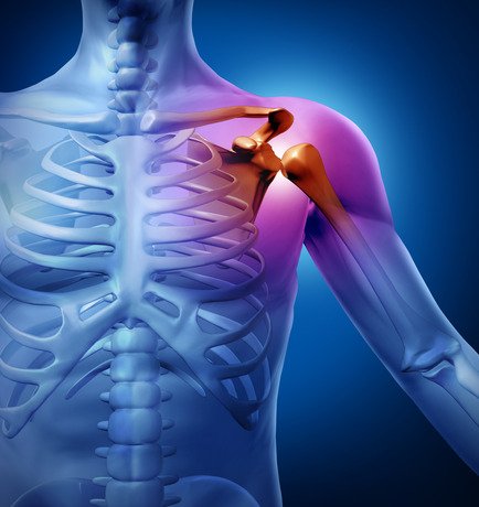 Human Shoulder Pain - Saffron4health