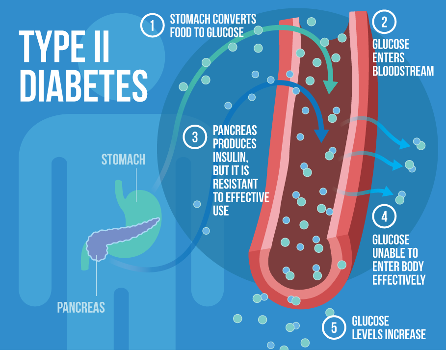 type-2-diabetes - Saffron4health